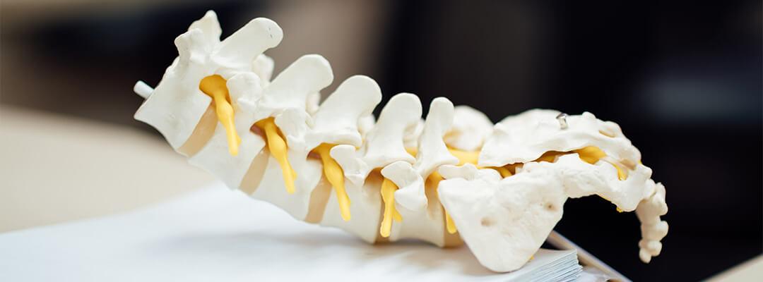 Back Pain After Accidents